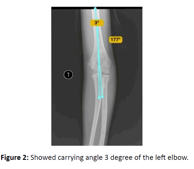 medical-case-carrying-angle