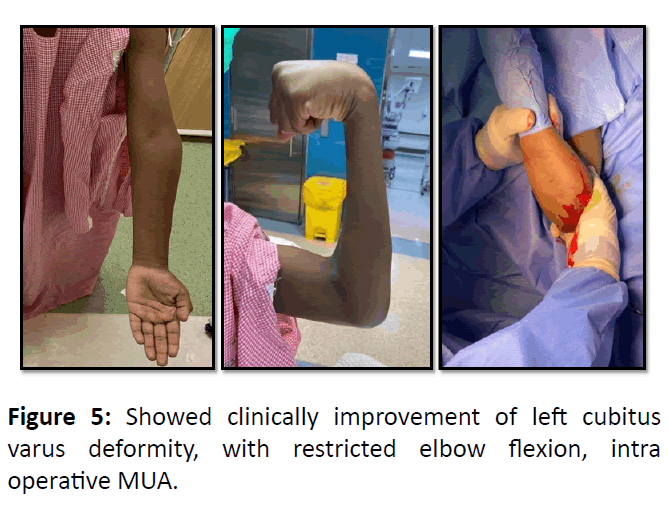 medical-case-elbow-flexion