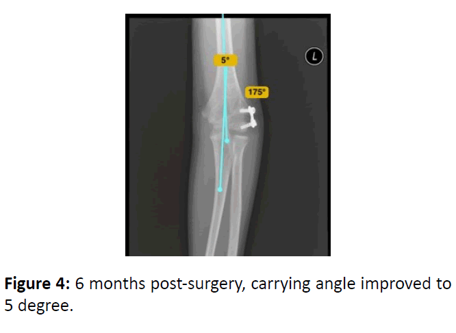 medical-case-post-surgery