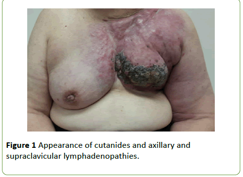 medical-case-reports-Appearance-cutanides