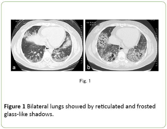 medical-case-reports-Bilateral-lungs