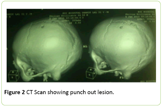 medical-case-reports-CT-Scan
