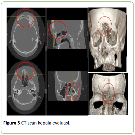 medical-case-reports-CT-scan