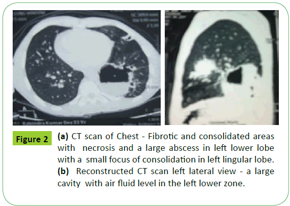 medical-case-reports-CT-scan-Chest
