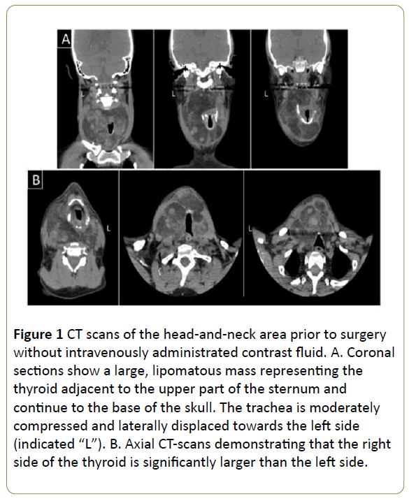 medical-case-reports-CT-scans
