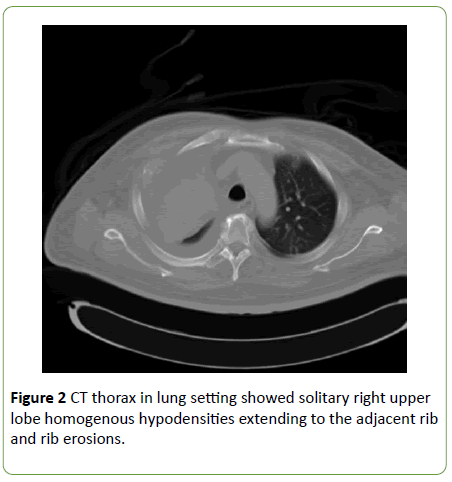 medical-case-reports-CT-thorax
