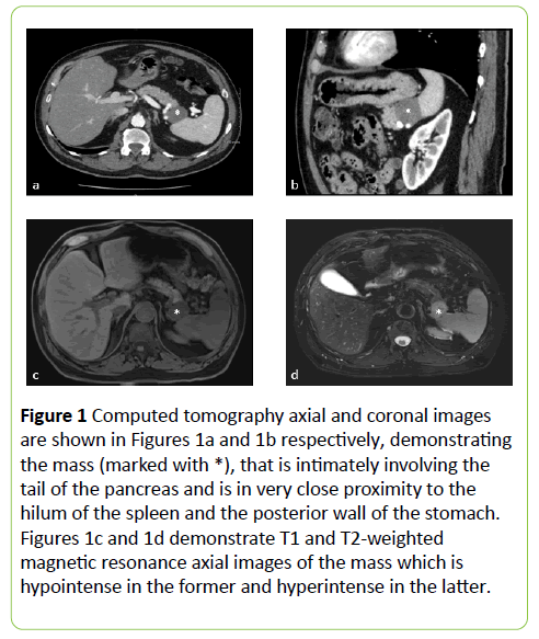 medical-case-reports-Computed-tomography-axial-coronal-images