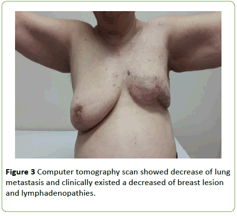 medical-case-reports-Computer-tomography