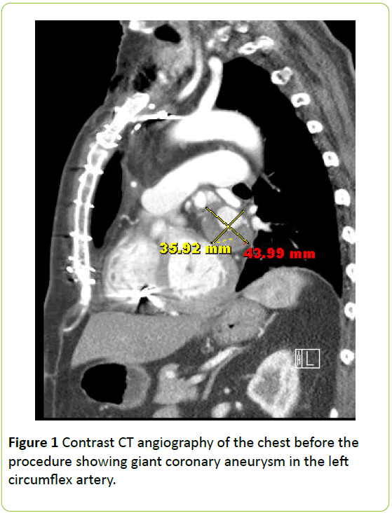 medical-case-reports-Contrast-angiography-chest