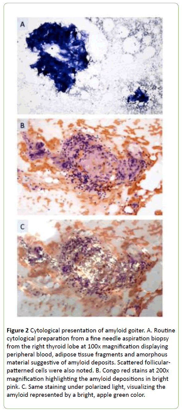 medical-case-reports-Cytological-presentation