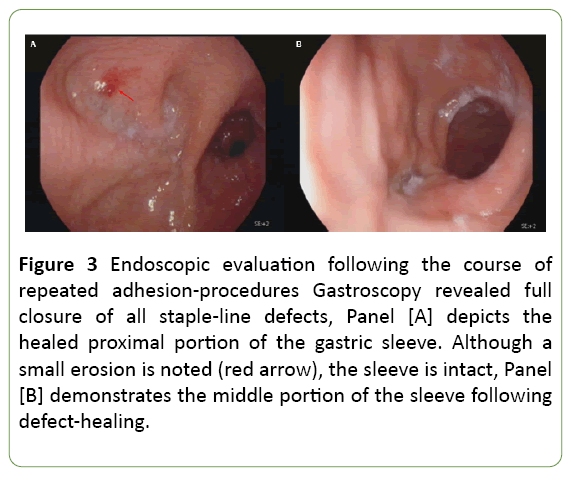 medical-case-reports-Endoscopic-evaluation