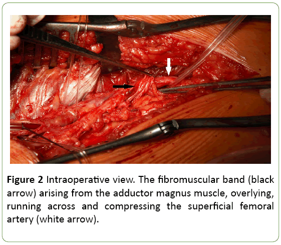 medical-case-reports-Intraoperative-view