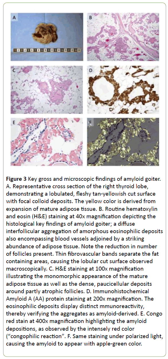 medical-case-reports-Key-gross