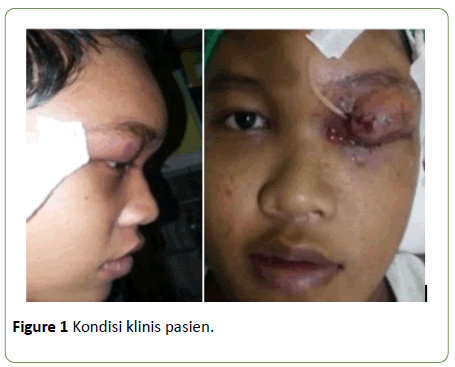 medical-case-reports-Kondisi