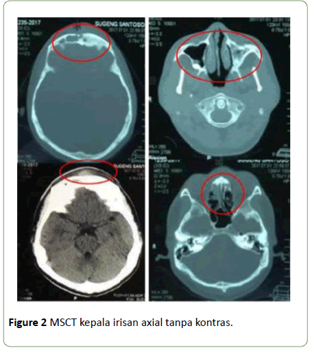 medical-case-reports-MSCT-kepala