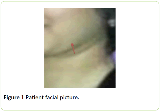 medical-case-reports-Patient-facial-picture