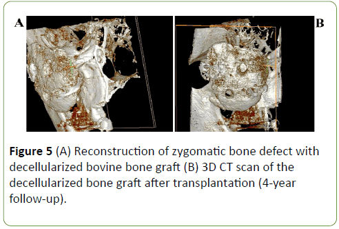medical-case-reports-Reconstruction