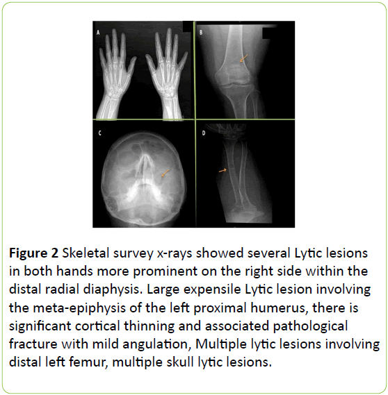 medical-case-reports-Skeletal-survey-several