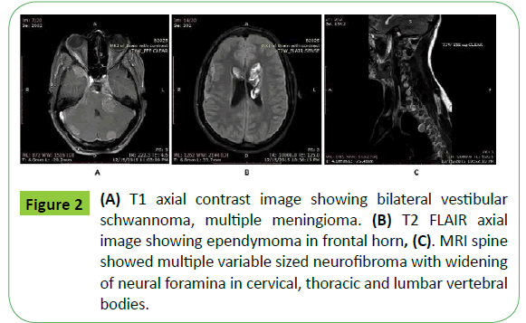 medical-case-reports-axial-contrast-vestibular