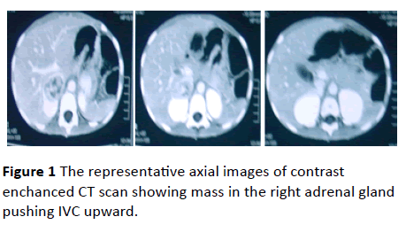 medical-case-reports-axial-images-contrast