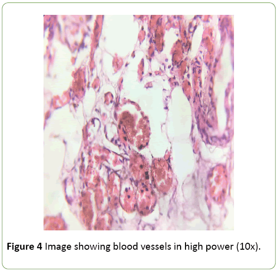 medical-case-reports-blood-vessels
