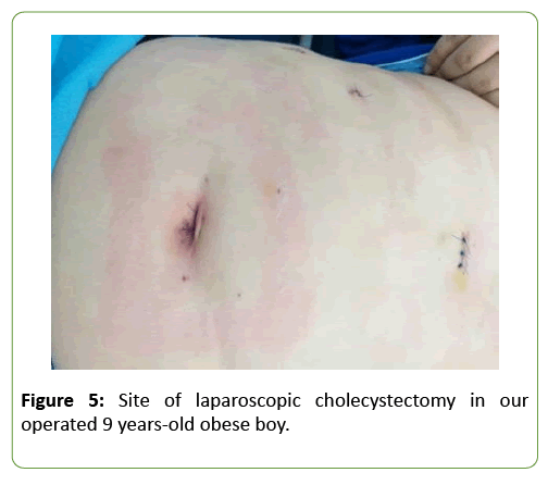 medical-case-reports-cholecystectomy