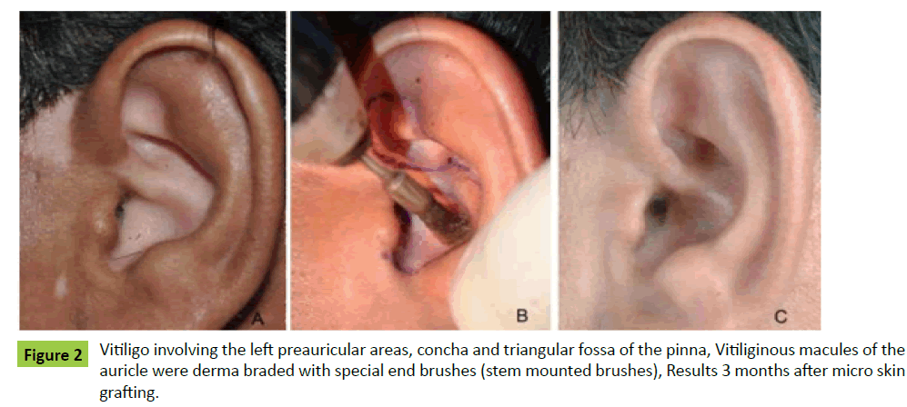 medical-case-reports-derma-braded