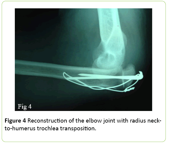 medical-case-reports-elbow-joint