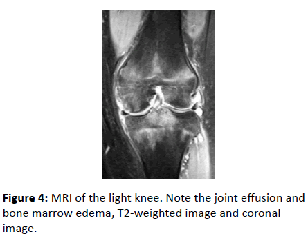 medical-case-reports-light-knee-Note