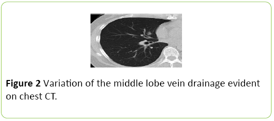 medical-case-reports-middle-lobe