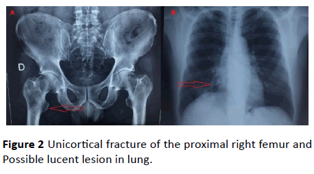 medical-case-reports-proximal-femur