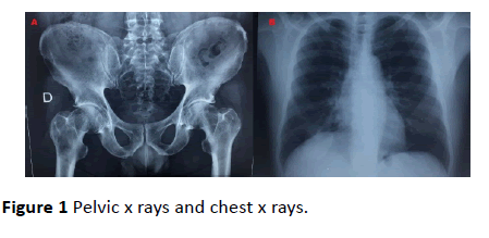 medical-case-reports-rays-chest