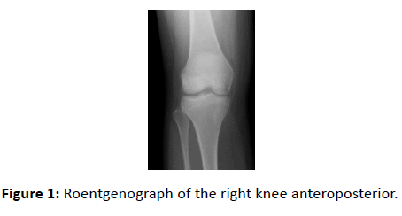 medical-case-reports-right-knee-anteroposterior