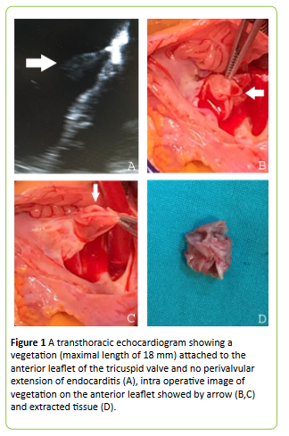 medical-case-reports-transthoracic-echocardiogram