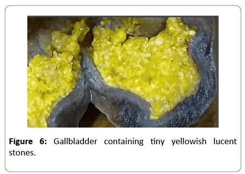 medical-case-reports-yellowish